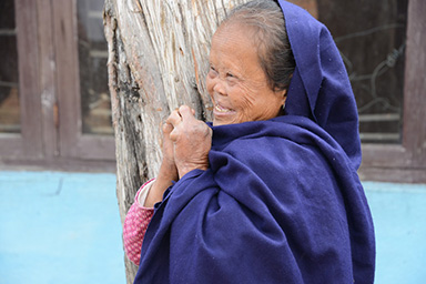 Photo of a woman affected by leprosy