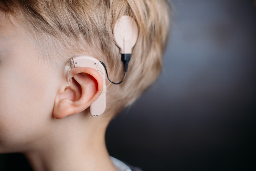 人工内耳を装用する子ども