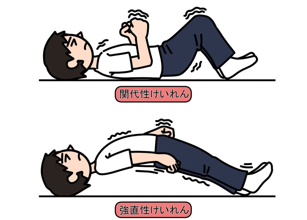 てんかんの原因は脳の電気信号の異常。薬で治る?専門家に聞いた | 日本財団ジャーナル