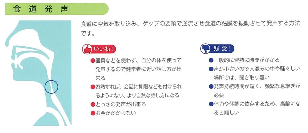 食道発声法の仕組みを解説した図

食道に空気を取り込み、ゲップの要領で逆流させ食道の粘膜を振動させて発声する方法
です。

いい点
・器具などを使わず、自分の体を使って発声するので健常者に近い話し方が出来る
・習熟すれば、会話に抑陽なども付けられるようになり、より自然な話し方になる
・とっさの発声が出来る
・お金がかからない


残念な点
・一般的に習熟に時間がかかる
・声が小さいので人混みの中や騒々しい場所では、聞き取り難い
・発声持続時間が短く、頻繁な息継ぎが必要
・体力や体調に依存するため、高齢になると難しい