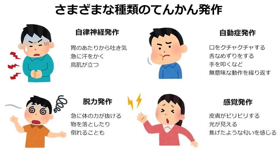 さまざまな種類のてんかん発作の例:
・自律神経発作
胃のあたりから吐き気
急に汗をかく
鳥肌が立つ
・自動症発作
口をクチャクチャする
舌なめずりをする
手を叩くなど無意味な動作を繰り返す
・脱力発作
急に体の力が抜ける
物を落としたり、倒れることも
・感覚発作
皮膚がビリビリする
光が見える
焦げたような匂いを感じる