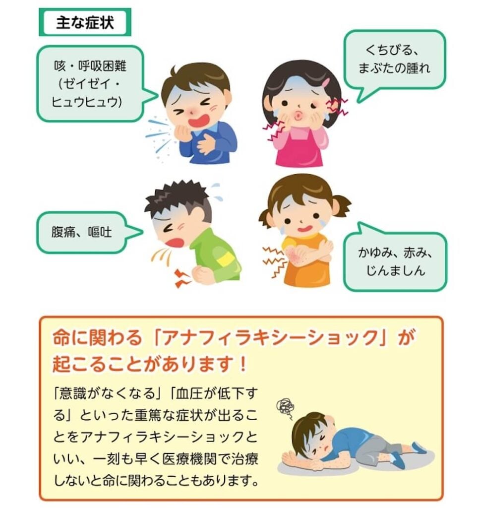 ・主な症状
咳・呼吸困難(ゼイゼイ・ヒュウヒュウ)
くちびる、まぶたの腫れ
腹痛、嘔吐
かゆみ、赤み、じんましん
・命に関わる 「アナフィラキシーショック」が起こることがあります!
「意識がなくなる」「血圧が低下する」といった重篤な症状が出ることをアナフィラキシーショックといい、一刻も早く医療機関で治療しないと命に関わることもあります