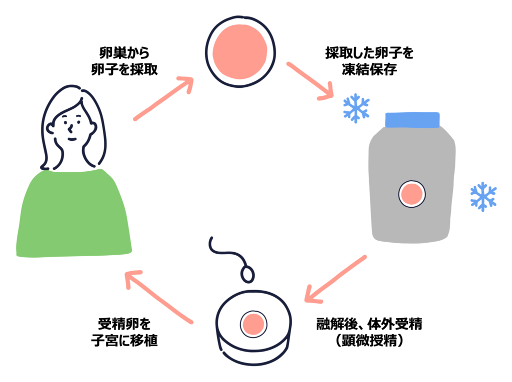 卵子凍結から妊娠までの流れ（卵子採取、凍結保存、体外受精、受精卵移植）を示した図解イラスト